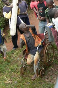 A disabled man with no hands begging for handouts.